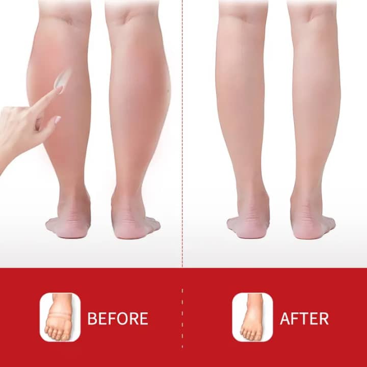 ⚠️ Fini gonflements des jambes et chevilles en 24H