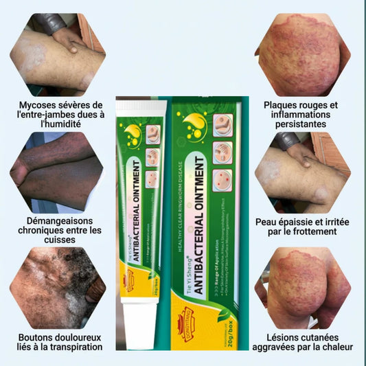 Crème Réparatrice Ultra ActiSoin Intime Confort – Apaise, Protège et Soulage les Zones Sensiblesve