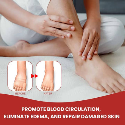 ⚠️ Fini gonflements des jambes et chevilles en 24H