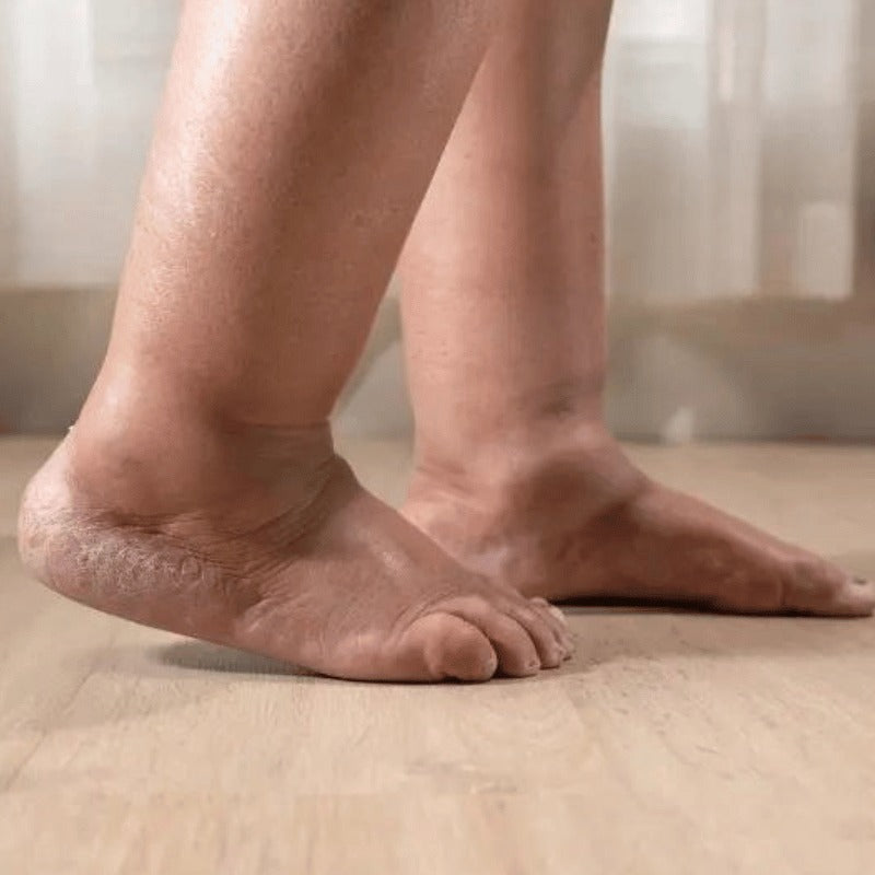 ⚠️ Fini gonflements des jambes et chevilles en 24H